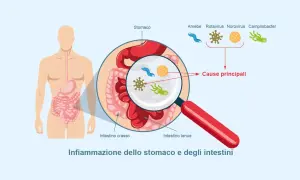 Illustrazione di un corpo umano con ingrandimento dello stomaco e degli intestini, mostrando i microrganismi causa di un virus intestinale 2026.