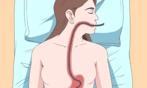 Illustrazione di un tubo che entra nell'esofago e nello stomaco, suggerendo come ruttare per digerire.