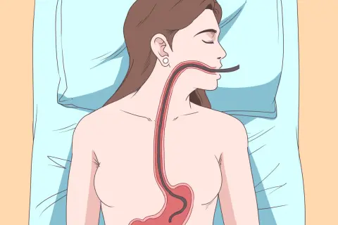 Illustrazione di un tubo che entra nell'esofago e nello stomaco, suggerendo come ruttare per digerire.