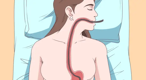 Illustrazione di un tubo che entra nell'esofago e nello stomaco, suggerendo come ruttare per digerire.