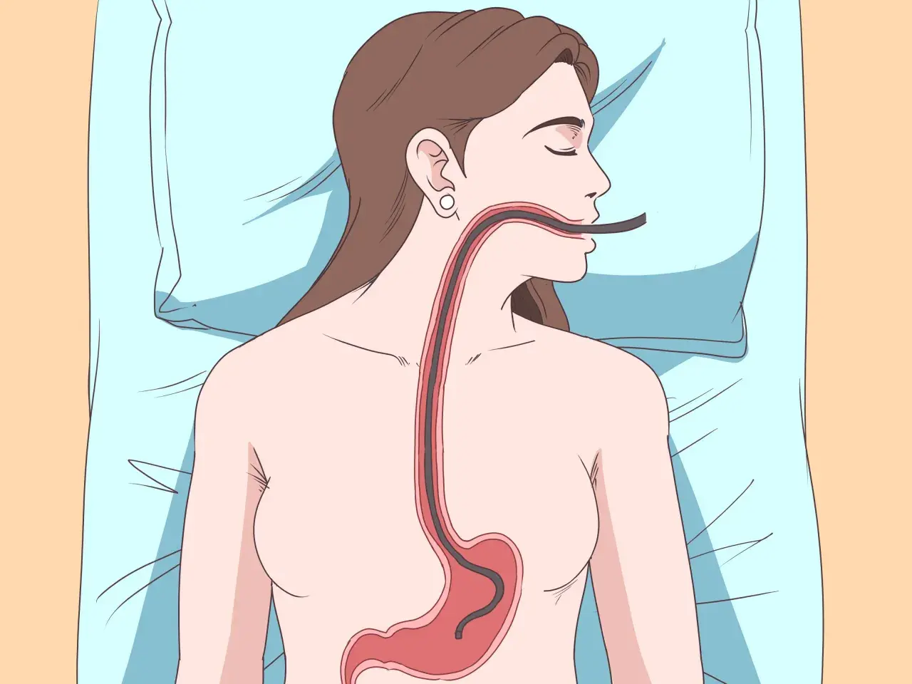 Illustrazione di un tubo che entra nell'esofago e nello stomaco, suggerendo come ruttare per digerire.