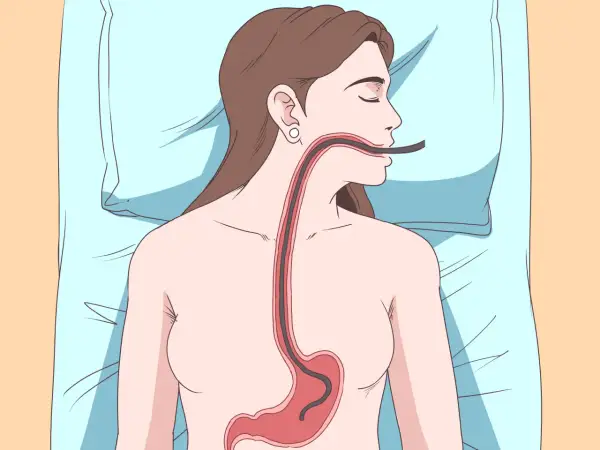 Illustrazione di un tubo che entra nell'esofago e nello stomaco, suggerendo come ruttare per digerire.
